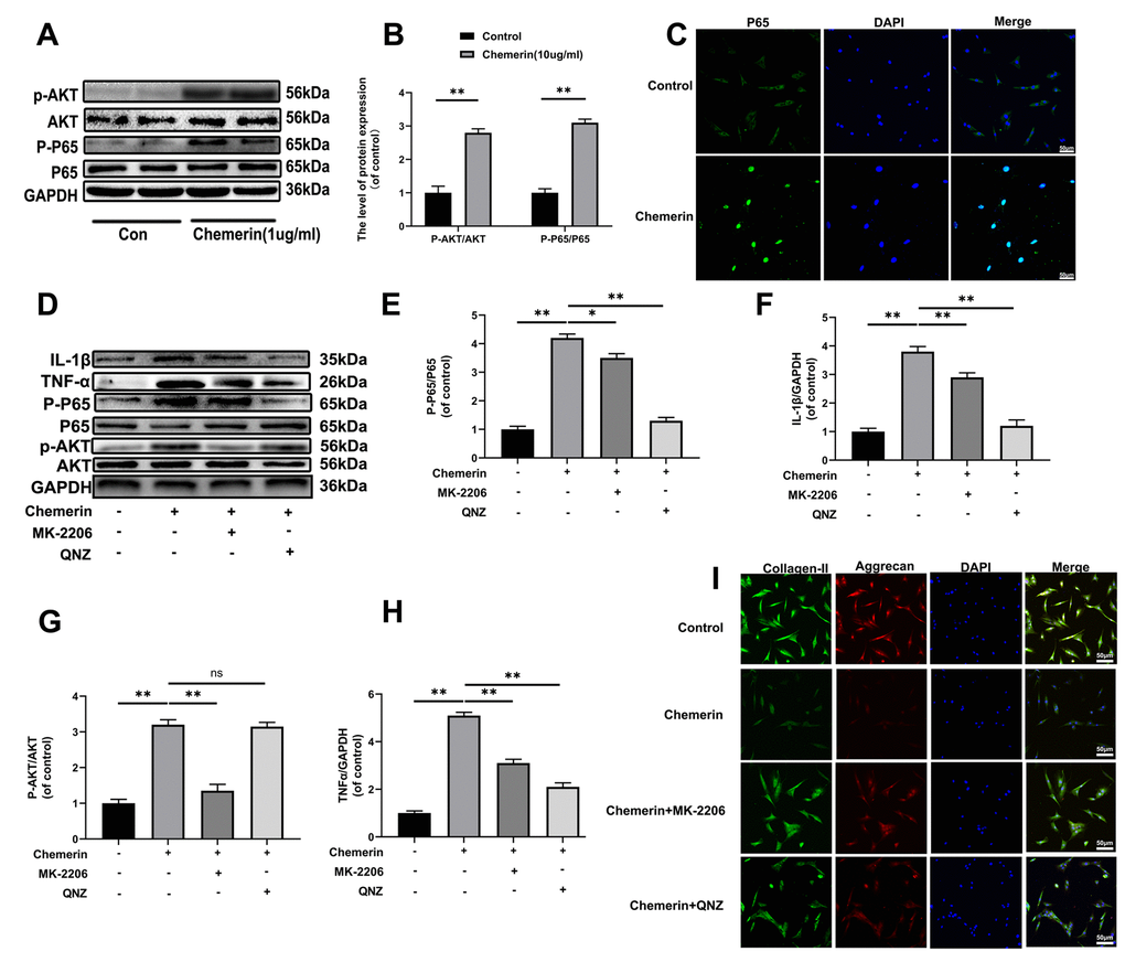 The AKT phosphorylation, and NF-kB signaling pathway were associated with chemerin induced cell damage. (A) The expression levels of p-AKT, AKT, p-p65, and p65 were visualized by western blotting. (B) Quantification of p-AKT, AKT, p-p65, and p65 immunoblots. (C) The expression levels of p65, and nuclear translocation were observed by immunofluorescence. (D) The expression levels of inflammatory mediators, and signaling pathway related proteins, such as IL-1β, TNF-α, p-AKT, AKT, p-p65, and p65 were analyzed by western blotting. (E–H) Quantification of IL-1β, TNF-α, p-AKT, AKT, p-p65, and p65 immunoblots. (I) Immunofluorescence of collagen II, and aggrecan in NPCs were observed by Nikon ECLIPSE Ti microscope (Nikon, Tokyo, Japan). Data are represented as mean ± SEM of three independent experiments, each done in triplicate. Significant differences between groups are indicated as **p 