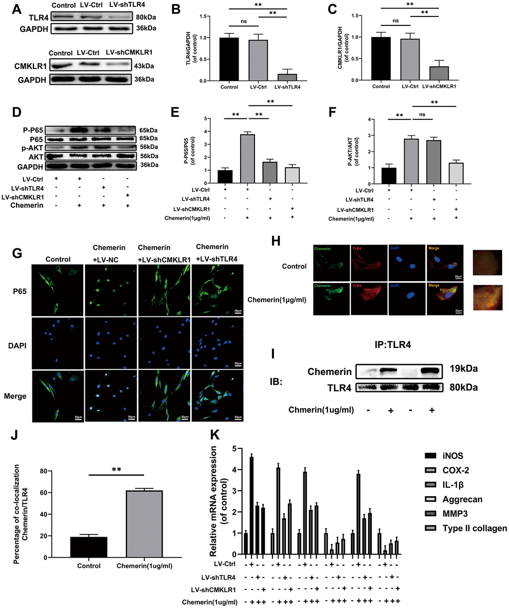 TLR4, and CMKLR1 were involved in chemerin-induced signaling pathway activation, ECM disorder and inflammatory response. (A) The expression levels of TLR4, and CMKLR1 were visualized by western blotting. (B, C) Quantification of TLR4, and CMKLR1 immunoblots. (D) The expression levels of p-AKT, AKT, p-p65, and p65 were evaluated by western blotting. (E, F) Quantification of p-AKT, AKT, p-p65, and p65 immunoblots. (G) The expression levels of p65, and nuclear translocation were observed by immunofluorescence. (H) Representative image of immunofluorescence double staining of TLR4, and chemerin in NPCs. (J) The quantification of the percentage of co-location of chemerin/TLR4 was detected by image J. (I) The co-immunoprecipitation data showed that compared with untreated group, the binding of chemerin to TLR4 was significantly increased after treatment with chemerin. (K) The mRNA expression levels of iNOS, COX-2, IL-1β, aggrecan, MMP3, and collagen II in NPCs were evaluated by RT- PCR. Data are represented as mean ± SEM of three independent experiments, each done in triplicate. Significant differences between groups are indicated as **p 