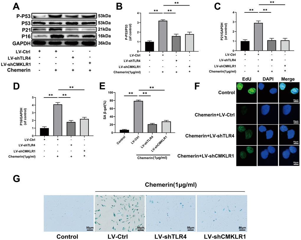 TLR4, and CMKLR1 knockdown attenuates the chemerin-induced senescence in human NPCs. (A) The expression levels of p-p53, p53, p21, and p16 were evaluated by western blotting. (B–D) Quantification of p-p53, p53, p21, and p16 immunoblots. (E, G) SA-β gal staining assay was performed in NPCs as treated above. (F) EdU microplate assay was performed in NPCs. Data are represented as mean ± SEM of three independent experiments, each done in triplicate. Significant differences between groups are indicated as **p 