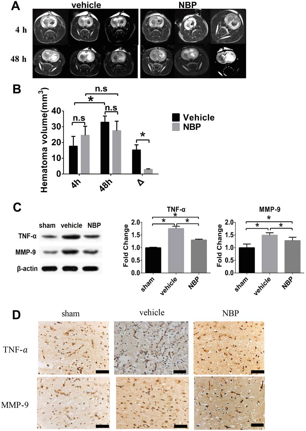 Effect of NBP on the changes of injured area volume post-ICH. (A) Representative T2-WI images of the vehicle and NBP groups; (B) The hematoma volume at different time points (4h and 48h post-ICH) were quantified; (C) TNF-α and MMP-9 expression in peri-hematoma brain tissue; (D) TNF-α and MMP-9 expression in peri-hematoma brain tissue measured by immunohistochemistry staining (scale: 200 μm). Δ represented the expanded injured area volume, which was calculated by subtracting the volume measured at 48 hours from that at 4 hours. Data are presented as the mean ± SD (n=3, each group). n.s., no significant difference; *, P 