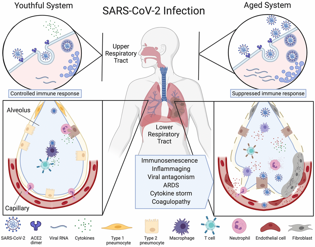 Understanding SARS-CoV-2-Mediated Inflammatory Responses: From Mechanisms  to Potential Therapeutic Tools