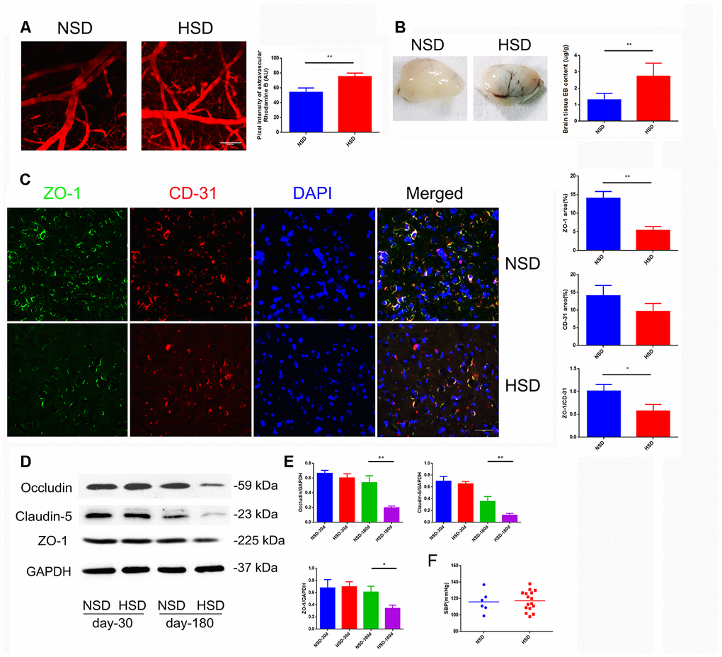 HSD increases cerebral microvascular permeability. (A) Representative images of the mice cerebral cortical microvessels and dye leakage at 10 min after injection of Rhodamine B isothiocyanate-dextran (n=3 per group). (B) Evans blue leakage analyzed in rats fed with selected diets for 180 days (n=3 per group). (C) ZO-1 (green) co-stained with CD31 (red), a microvascular endothelia marker, and DAPI (blue; n=6 per group) in the rats brain slices. (D, E) Expression of Occludin, Claudin-5 and ZO-1 in the brain tissues from rats analyzed by immunoblotting. (F) Systolic blood pressure (SBP) of rats fed with NSD or HSD for 180 days. *PP