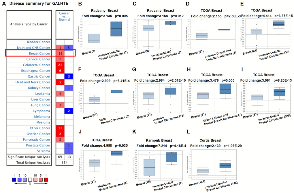 mRNA level of GALNT6 in different tumor types in the Oncomine database. (A) This graphic presentation showed the number of datasets with statistically significant mRNA high expression (red) or low expression (blue) of GALNT6 (cancer vs. normal tissue). The fold change was defined as 2 and p-value threshold was set up at 0.05. The number in each cell represents the number of analyses that met the threshold within the analysis and cancer types. The gene rank was analyzed by percentile of target gene in the top of all genes as measured in each research. Cell color is determined by the best gene rank percentile for analyses within the cell. Gene rank: Genes are ranked by their p-value for every analysis. (B–L) Comparison of GALNT6 expression in normal and breast cancer tissues.