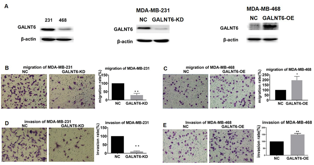 Effect of GALNT6 on MDA-MB-231 and MDA-MB-468 cell migration and invasion. (A) GALNT6 expression was detected by western blot in MDA-MB-231 and MDA-MB-468 cells, respectively (left). The efficiency of GALNT6 knock-down in MDA-MB-231 cells (middle) and overexpression in MDA-MB-468 cells (right). β-actin was used as internal control. (B–E) The effect of GALNT6-knockdown or -overexpression on migratory and invasive abilities of MDA-MB-231 and MDA-MB-468 cells.