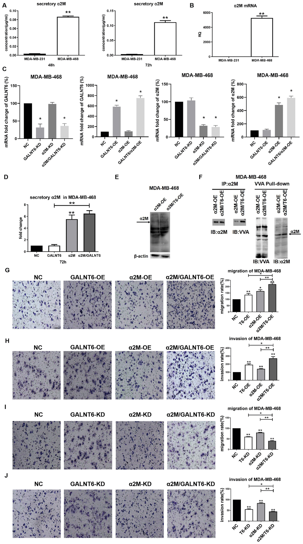 Effect of mucin-type glycosylation of α2M on migration and invasion in breast cancer cells. (A) The secretory level of α2M in MDA-MB-231 and MDA-MB-468 cells. (B) The mRNA level of α2M in MDA-MB-231 and MDA-MB-468 cells. (C) The mRNA level of α2M in MDA-MB-468/NC, MDA-MB-468/OE-GALNT6, MDA-MB-468/OE-α2M, MDA-MB-468/OE-GALNT6/α2M. (D) The secretory level of α2M in α2M and GALNT6 OE MDA-MB-468 cells. (E) The levels of O-GalNAcylation in α2M OE and α2M/GALNT6 OE MDA-MB-468 cells were verified by Western blotting using anti-O-GalNAc antibody. The arrow indicates GalNAc-conjugated α2M. β-actin was used as internal control. (F) Mucin-type O-glycosylation of α2M was detected by VVA lectin pull-down assay in MDA-MB-468/OE-α2M and MDA-MB-468/OE-GALNT6/α2M cells. (G–J) Migratory and invasive abilities of MDA-MB-468 cells were compared between knockdown or overexpression of GALNT6 and α2M and corresponding negative control. T6, GALNT6.