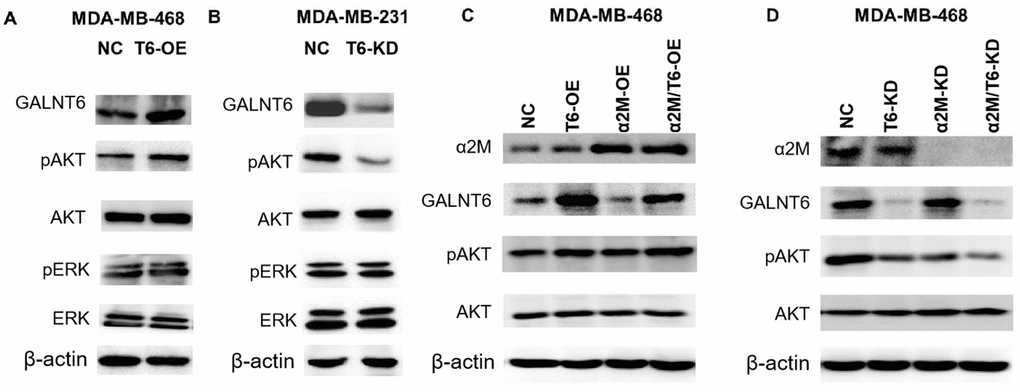 Effect of the GALNT6-α2M axis on the activation of PI3K/Akt signaling. (A) Western blot analysis of phosphorylation and baseline protein expression of Akt and ERK1/2 in MDA-MB-468/NC and MDA-MB-468/OE-GALNT6 cells. (B) Western blot analysis of phosphorylation and baseline protein expression of Akt and ERK1/2 in MDA-MB-231/NC and MDA-MB-231/KD-GALNT6 cells. (C) Western blot analysis of phosphorylation and baseline protein expression of Akt in MDA-MB-468 cells transfected with GALNT6 and/or α2M. (D) Western blot analysis of phosphorylation and baseline protein expression of Akt in MDA-MB-468 cells transfected with siRNA targeting GALNT6 and/or α2M. β-actin was used as internal control.