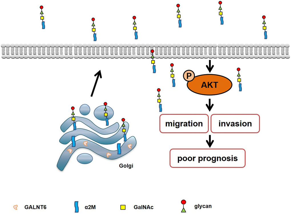 Schematic diagram of the mechanism of GALNT6-promoted metastasis through increasing mucin-type O-glycosylation of α2M in breast cancer.