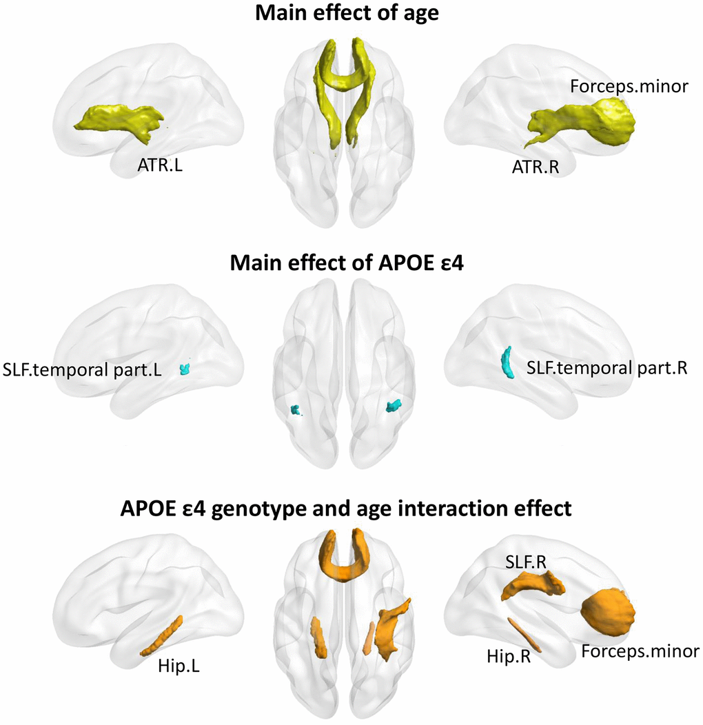 The age×APOEε4 effects on fiber bundles. Significant main effect of age (Top), main effect of APOEε4 genotype (Middle), and age×APOEε4 interaction (Bottom) on fibers were found (p