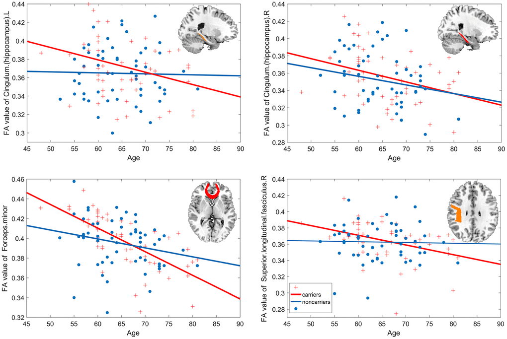 Age-related white matter integrity decline. The estimated age trajectories from the linear regression analyses of bilateral cingulum. hippocampus, forceps minor, and right superior longitudinal fasciculus for APOE ε4 carriers (red line) and noncarriers (blue line).