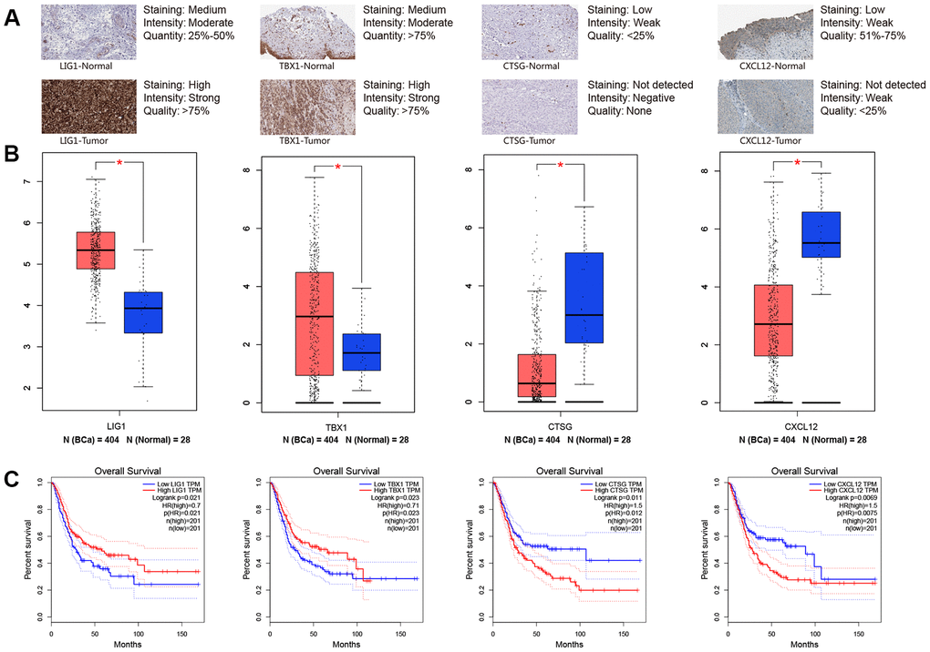 Immunohistochemistry from THPA (The Human Protein Atlas) and online analyses from GEPIA (Gene Expression Profiling Interactive Analysis) were used to explore four key immune-related genes (LIG1, TBX1, CTSG and CXCL12). (A) Immunohistochemistry between normal bladder tissues and BCa (bladder urothelial carcinoma) tissues; (B) Gene expression level between normal bladder tissues and BCa tissues for LIG1, TBX1, CTSG and CXCL12, respectively; (C) Kaplan-Meier survival curve of LIG1, TBX1, CTSG and CXCL12, respectively. * P-value 