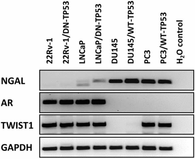 Influences of TP53 and the anti-aging DDR1 receptor in controlling 