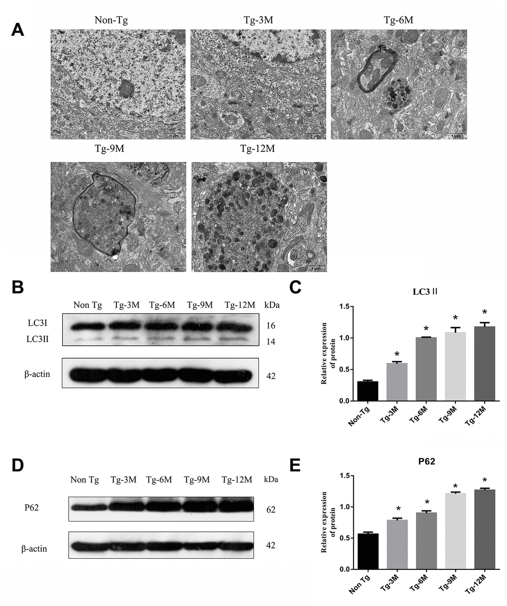 The function of lysosome was impaired and the expression of axonal transport molecular motor was decreased in hippocampus of APP/PS1 double transgenic mice. (A) Transmission electron microscopy images of each group. (B–E) Western blot analysis of (B, C) LC3II, and (D, E) P62 in each group. The data represent as mean {plus minus} SEM of a typical series of 3 experiments. (* P