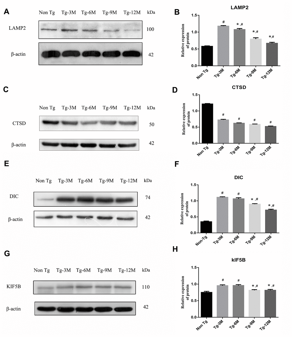 NEW - The function of lysosome in hippocampus of APP/PS1 double transgenic mice was impaired and the expression of axonal transport molecular motor was decreased. (A–D) Western blot analysis of LAMP2 (A, B) and CTSD (C, D) in each group. (E–H) Western blot analysis of retrograde axonal transport molecular motor DIC (E, F) and forward axonal transport molecular motor KIF 5B (G–H) in each group. The data represent as mean ± SEM of a typical series of 3 experiments. (# P