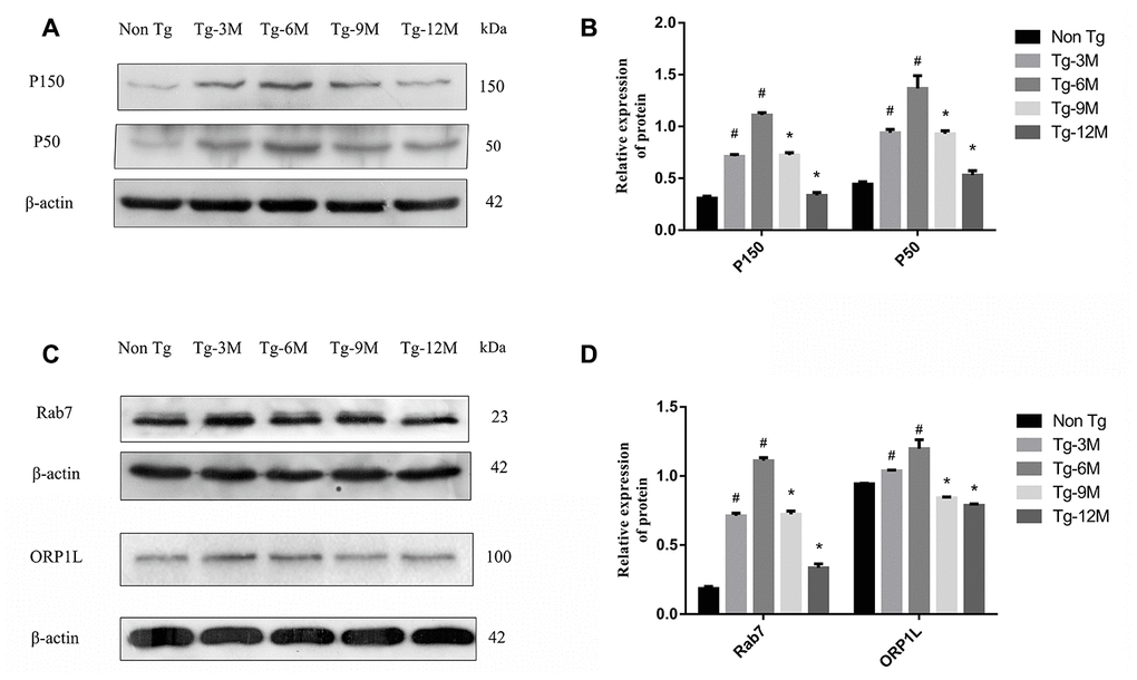 Decreased expression of retrograde axon transport related proteins P150, P50, Rab7 and ORP1L in hippocampus of APP/PS1 double transgenic mice with age. (A, B) Western blot analysis of dynactin proteins P150 and P50 in each group. (C, D) Western blot analysis of Rab7 and ORP1L in each group. The data represent as mean {plus minus} SEM of a typical series of 3 experiments. (# P
