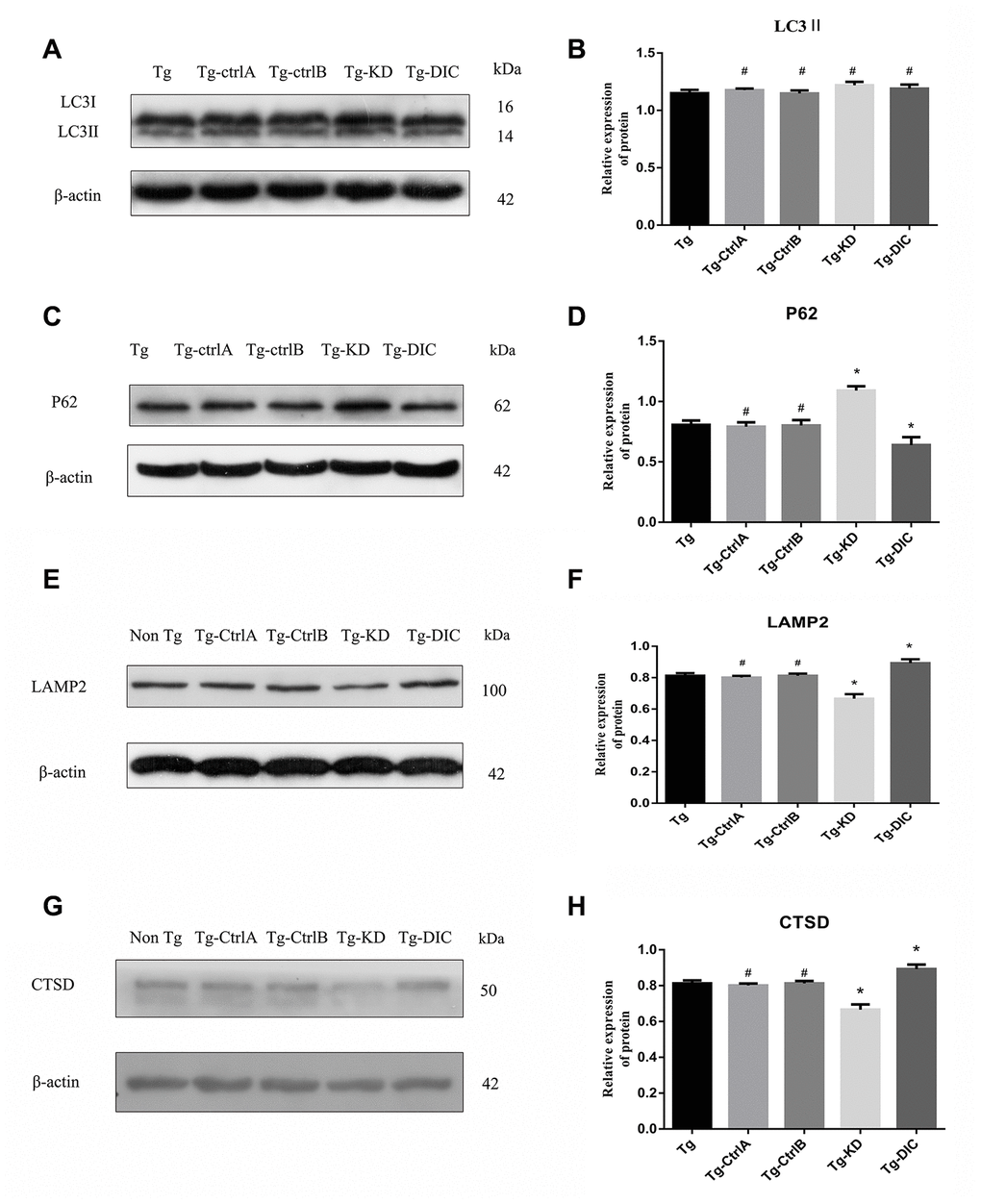 DIC promoted the degradation of hippocampal autophagosomes and improved the function of lysosomes in APP/PS1 double transgenic mice. (A–D) Western blot analysis of (A, B) LC3II, and (C, D) P62 in each group. (E–H) Western blot analysis of (E, F) LAMP2, and (G–H) CTSD in each group. The data represent as mean ± SEM of a typical series of 3 experiments. (# P>0.05,* P