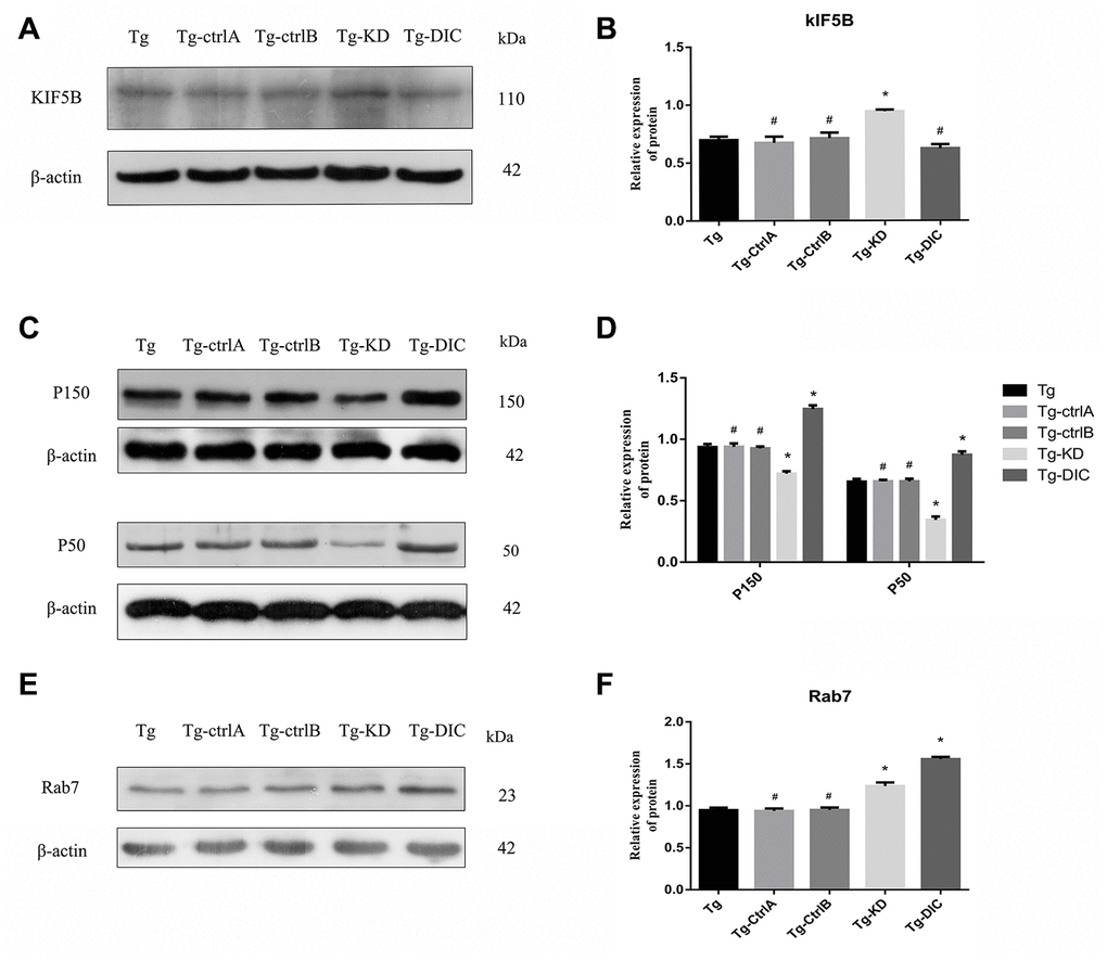 DIC inhibited the expression of KIF5B and enhanced the expression of P150, P50 and Rab7 in hippocampus of APP/PS1 double transgenic mice. (A–B) Western blot analysis of forward axonal transport molecular motor KIF5Bin each group. (C–D) Western blot analysis of dynactin proteins P150 and P50 in each group. (E–F) Western blot analysis of Rab7 in each group. The data represent as mean {plus minus} SEM of a typical series of 3 experiments. (# P>0.05,* P