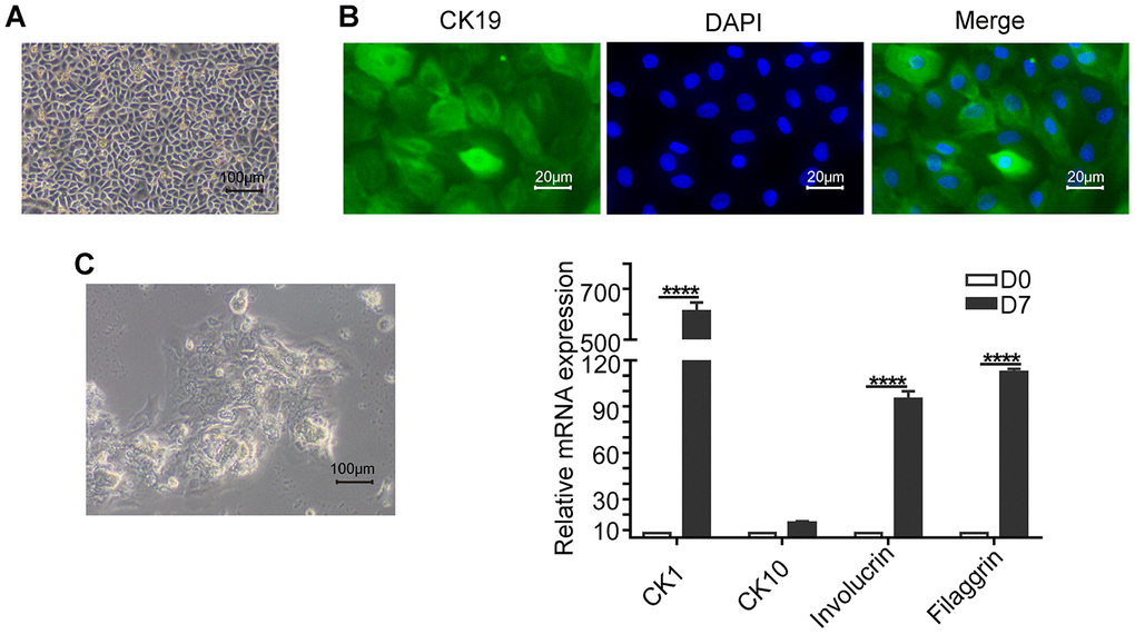 Basic characterization of keratinocytes. (A) Representative phase-contrast bright field image (scale bar: 100 μm) shows a confluent culture of the human skin keratinocytes. (B) Fluorescence images (scale bar: 20 μm) show positive expression of the epithelial stem cell marker, Cytokeratin 19 (CK19; green) in the keratinocytes. The nuclei are stained with DAPI (blue). (C) Representative phase-contrast bright field image (scale bar: 100 μm) shows agglomerate morphology of keratinocytes when grown in medium containing 1.2mM Ca2+ for 7 days. (D) Histogram plots shows the relative mRNA levels of differentiation markers CK1 (Cytokeratin 1), CK10 (Cytokeratin 10), Involucrin and Filaggrin levels in the keratinocytes on days 0 and 7. Note: The values are expressed as means ±SEM; ****p 