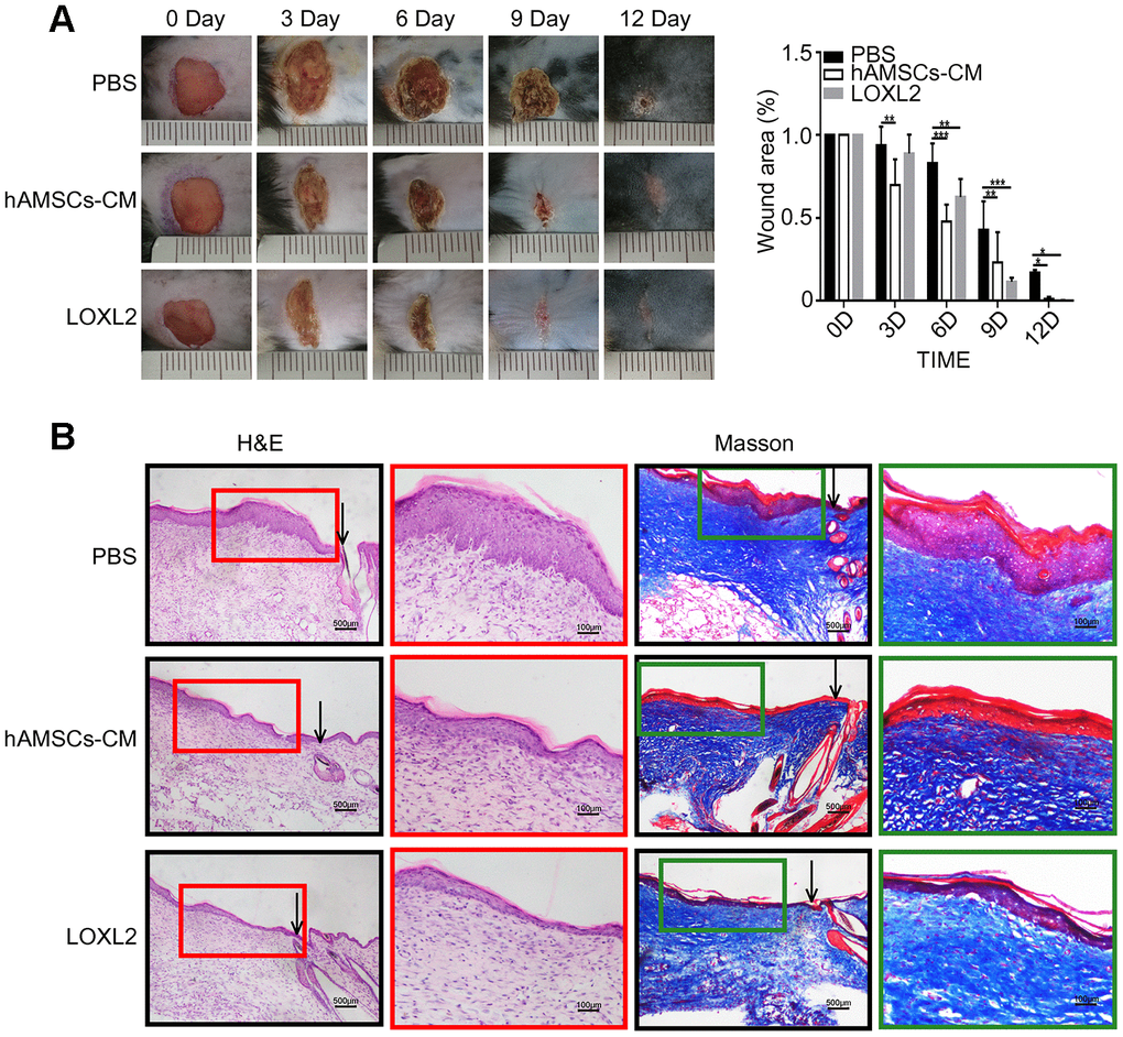LOXL2 (Lysyl oxidase-like 2) promoted wound healing in the mouse model. (A) Representative photographs show the status of full-thickness excisional wounds in mice on days 0, 3, 6, 9 and 12. The wounds were treated with PBS (phosphate-buffered saline), 5X hAMSCs-CM (hAMSCs-CM concentrated five times), or LOXL2 (4ug). The histogram plot (right) shows the wound closure rate in the PBS, 5X hAMSCs-CM, and LOXL2 mice on days 0, 3, 6, 9 and 12. (B). Representative images (low and high resolution) show H&E (Hematoxylin and eosin staining) and Masson staining of wounded skin sections in mice belonging to PBS, 5X hAMSCs-CM and LOXL2 groups on day 14. Note: The values are shown as means ±SEM. ***p 