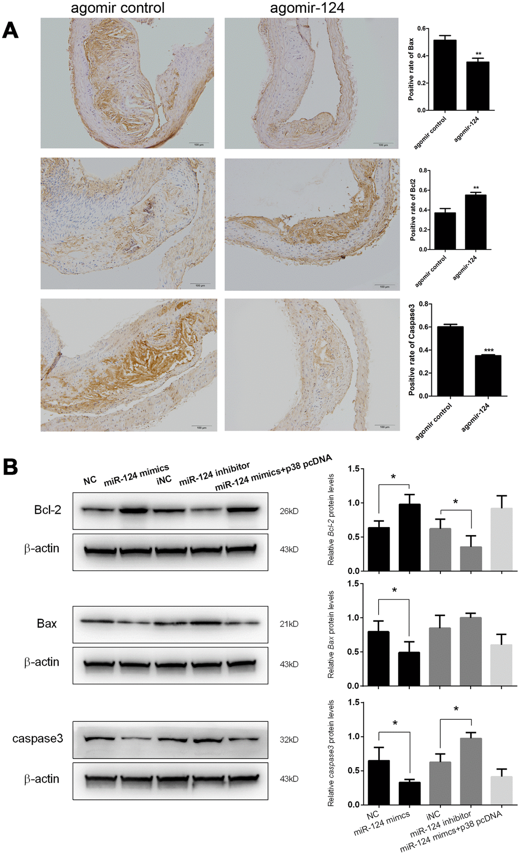 miR-124 suppressed the expression of pro-apoptotic factors but promoted the expression of anti-apoptotic factors. (A) Immunohistochemistry analysis of the pro-apoptotic factors and anti-apoptotic factors. Bar = 100 μm. (B) Western blot analysis of the protein levels of the pro-apoptotic factors and anti-apoptotic factors in RAW264.7 cells transfected with miR-124 mimics, inhibitor, negative control or miR-124 mimics + p38 pcDNA, then treated with ox-LDL. NC, negative control of miR-124 mimics; iNC, negative control of miR-124 inhibitor. β-actin was used as an internal reference in Western blot. *, P P P 