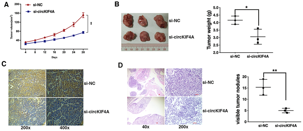 Knockdown of circKIF4A inhibits ovarian cancer growth and metastasis in vivo. (A) The growth curves of tumors were shown. (B) Representative images of xenograft tumors (left) and the tumor weight was summarized (right). (C) IHC staining of Ki-67 in ovarian cancer cells transfected with si-NC of si-circKIF4A. (D) Representative images of lung metastatic nodules on HE-stained sections (left) and the number of metastatic nodules was quantified (right). *P P 