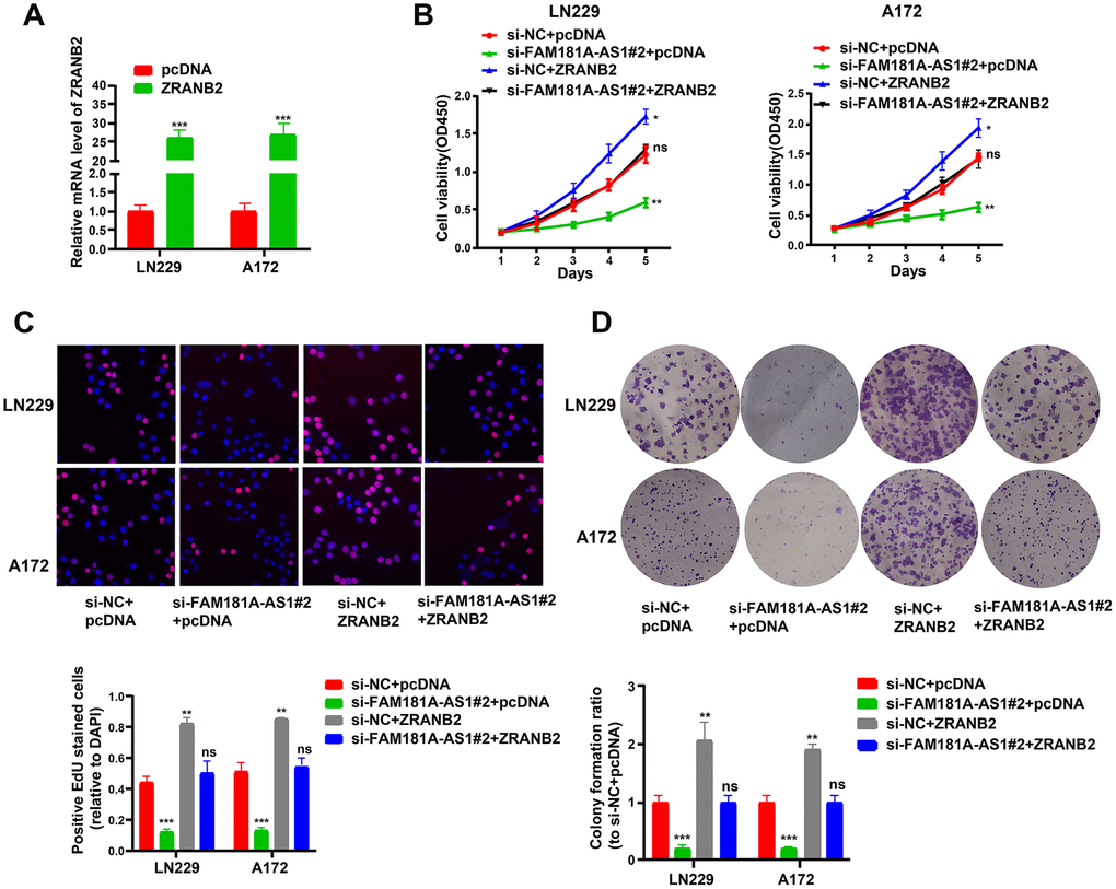 ZRANB2 overexpression promotes proliferation of FAM181A-AS1 downregulating glioma cells. (A) Transfection efficiency of ZRANB2-expression plasmid in LN229 and A172 cell lines is examined through qRT-PCR. (B, C) CCK-8 and EdU analyses of the cell viability after transfection with FAM181A-AS1 siRNA and (or) ZRANB2-expression plasmid in LN229 and A172 cell lines. (D) Colony formation analysis of the cell colony abilities after transfection with FAM181A-AS1 siRNA plasmid and (or) ZRANB2-expression plasmid in LN229 and A172 cell lines. **PP