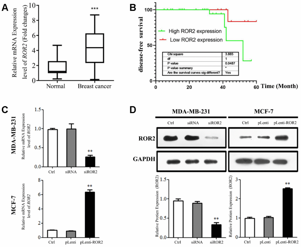 High ROR2 expression correlates with poor clinical outcome in BC patients. (A) ROR2 mRNA levels in 45 pairs of BC tissues compared with corresponding adjacent normal tissues. (B) Kaplan-Meier DFS curves for 45 BC patients classified according to ROR2 mRNA levels. (C, D) ROR2 expression analyzed by qRT-PCR (C) and Western blotting (D) in MDA-MB-231 and MCF-7 cells transfected with siROR2 and pLenti-ROR2 plasmids. Image J software (version 1.48, NIH, USA) was used for the quantitative analysis of ROR2 protein levels analyzed by western blotting. Results are shown as means ± SD, n=3; *p