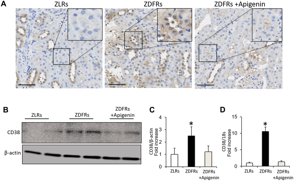 Apigenin downregulates CD38 in diabetic rats. (A) Representative photographs of immunohistochemical staining of CD38 in the tubulointerstitial area (scale bar: 100 μm). (B) Western blotting of CD38 and control β-actin in the renal cortex. (C) Densitometric evaluation of the western blotting shown in panel B (n=6). (D) Quantitative RT-PCR of CD38 mRNA normalized to 18S, in the renal cortex (n=6). All data represent the mean ± standard deviation (SD). *p