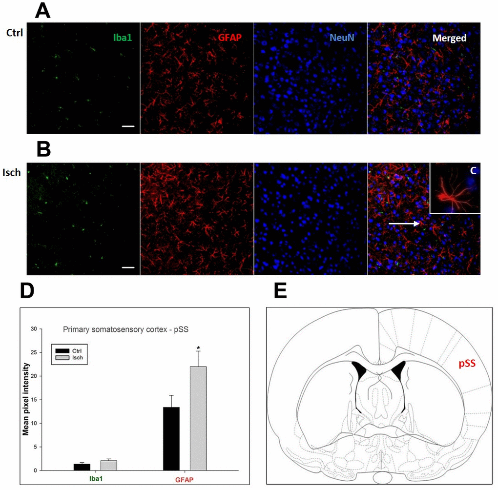 Confocal images of microglia and astrocytes in the post-ischemic primary somatosensory cortex (pSS) of the rat brain. Triple immunofluorescence labeling microglia with Iba1 (green), astrocytes with GFAP (red), and neurons with NeuN (blue). The scale bar represents 50 μm. (A) Ctrl – control brain, (B) Isch – post-ischemic brain, (C) Inset indicating an astrocyte interaction with neurons (8x), (D) Quantification of the mean pixel intensities for Iba1 and GFAP signals of post-ischemic vs. control animals with 2 years survival. Values are presented as mean ± SEM. * pCtrl = 11, nIsch = 11, n = number of analyzed cross sections. (E) Schematic representation of the rat striatal level with pSS region indicated.