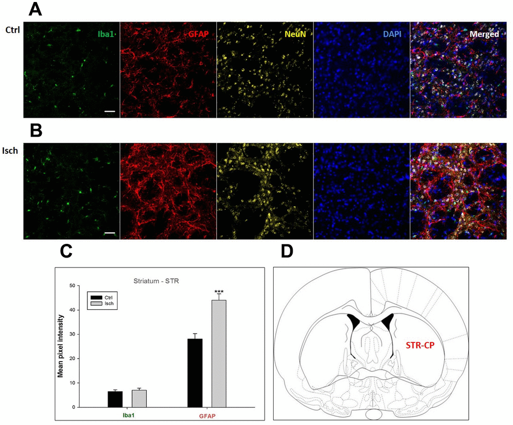 Confocal images of microglia and astrocytes in the post-ischemic striatum-caudoputamen (STR- CP) of the rat brain. Fourfold immunofluorescence labeling microglia with Iba1 (green), astrocytes with GFAP (red), neurons with NeuN (yellow), and nuclei with DAPI (blue). The scale bar represents 50 μm. (A) Ctrl – control brain, (B) Isch – post-ischemic brain, (C) Quantification of the mean pixel intensities for Iba1 and GFAP signals of post-ischemic vs. control animals with 2 years survival. Values are presented as mean ± SEM. *** pCtrl = 16, nIsch = 16, n = number of analyzed cross sections. (D) Schematic representation at rat striatal level with STR-CP region indicated.