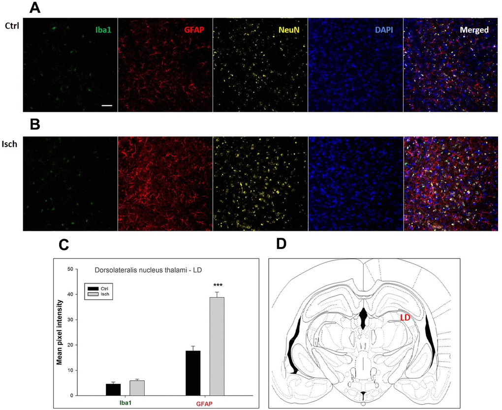 Confocal images of microglia and astrocytes in the post-ischemic dorso-lateral nucleus of thalami (LD) of the rat brain. Fourfold immunofluorescence labeling microglia with Iba1 (green), astrocytes with GFAP (red), neurons with NeuN (yellow), and nuclei with DAPI (blue). The scale bar represents 50 μm. (A) Ctrl – control brain, (B) Isch – post-ischemic brain, (C) Quantification of the mean pixel intensities for Iba1 and GFAP signals of post-ischemic vs. control animals with 2 years survival. Values are presented as mean ± SEM. *** pCtrl = 18, nIsch = 18, n = number of analyzed cross sections. (D) Schematic representation of the rat hippocampus level with LD region indicated.