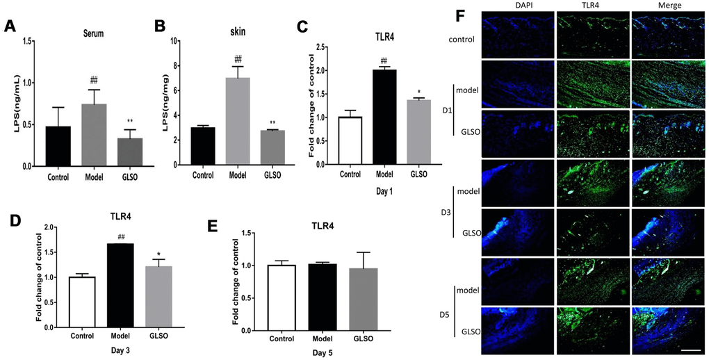 GLSO downregulated the levels of LPS and TLR4 on early skin wound healing. LPS levels in murine serum (A) and skin (B) was examined by the ELISA. The qPCR analysis revealed the levels of TLR4 at the murine wound edge on day 1 (C), day 3 (D) and day 5 (E). (F) Images of immunofluorescence from the model group and GLSO group at different healing time points were taken by immunofluorescent microscope and were compared with the control group under the microscope 200X. Scale bar = 200 μm. The data are indicated as the mean ± SD. ##P and **P ###P and ***P #P: control vs model, *P: GLSO vs model).