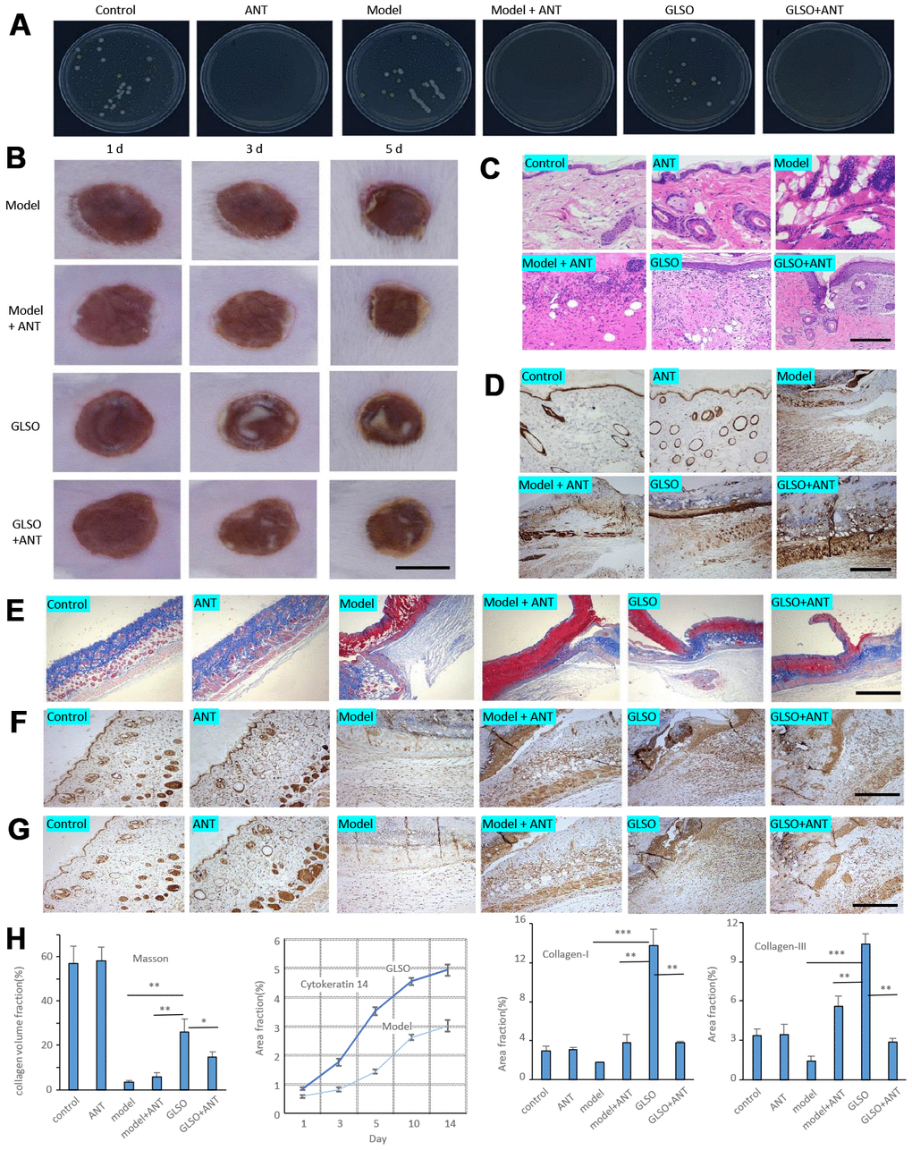 GLSO accelerates the skin wound healing more rapidly than the group with treatment of antibiotics. (A) The culture of skin microbiota on each group after 7 days with the treatment of antibiotics. (B) Gross examination of the wound area on each group. Scale bar =6 mm. (C) H&E staining of the wound tissue sections. (D) Immunohistochemical analysis of cytokeratin 14 under the microscope 100X, scale bar=400 μm. (E) Masson’s Trichrome staining, scale bar=1 mm. Immunohistochemical analysis of Collagen I (F) and Collagen III (G) at the murine skin wound on each group under the microscope 100X, scale bar=0.4 mm. (H) Quantitative analysis of Masson’s Trichrome staining, and immunostaining of cytokeratin 14 (quantitation results of Fig 1E), Collagen I, and Collagen III (n=3 each group). The data are indicated as the mean±SD. *P**P ***P *P: other groups vs GLSO).