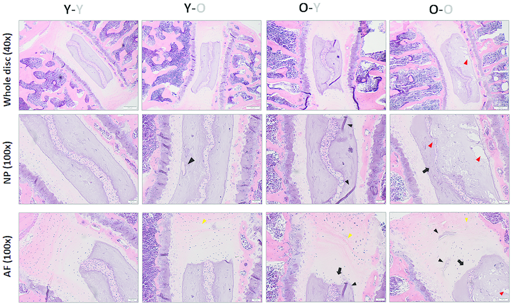 Impact of circulatory factors on gross disc morphology. H&E staining of lumbar disc was performed to assess the gross morphological changes with aging. Compared to discs of Y-Y mice, discs of O-O mice exhibited increasing loss of a distinct NP/AF boundary (black arrows), loss of AF structure in which the AF lamellae become less concentric and more serpentine, with each lamellae spaced farther apart (yellow arrowheads), loss of NP matrix, indicated by large empty space gaps (red arrowheads) and fissures/clefts (black arrowheads). These degradative changes were also observed in Y-O mice but blunted in the O-Y mice, suggesting the global influences of blood factors on disc aging phenotype. Disc sections from four representative mice of each group (Y-Y, Y-O, O-Y, O-O) are shown. Scale bar = 50μm of H&E stained disc sections.