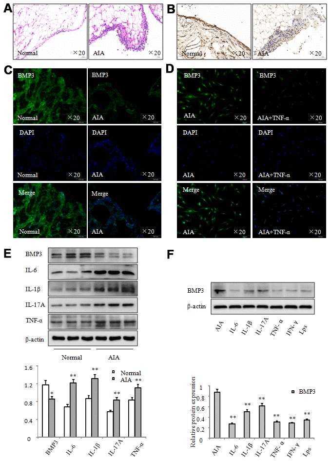 BMP3 expression was significantly downregulated in AIA. (A) Representative H&E staining of normal and AIA rat synovial tissues (original magnification, ×20). (B) BMP3 expression in normal and AIA rat synovial tissues was analyzed using IHC staining (original magnification, ×20). (C) BMP3 expression in normal and AIA rat synovial tissues was analyzed using immunofluorescence staining (original magnification, ×20). (D) BMP3 expression in FLS from AIA rats treated with TNF-α was analyzed using immunofluorescence staining (original magnification, ×10). (E) BMP3 protein levels in normal and AIA synovial tissues were analyzed using western blot. (F) BMP3 protein levels in AIA FLS treated with various inflammation factors were analyzed using western blot. All values are expressed as the mean ± SD. *P **P 