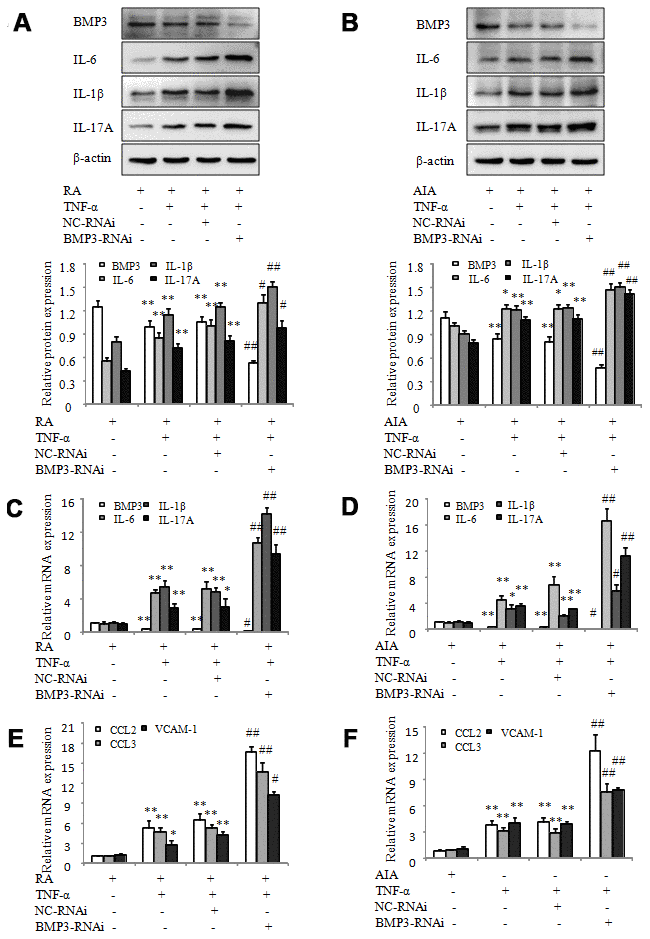 BMP3 siRNA silencing increases the proinflammatory cytokines and chemokines in RA and AIA FLS. (A) The protein levels of BMP3, IL-6, IL-1β, and IL-17A in TNF-α–treated RA FLS transfected with BMP3 siRNA were analyzed using western blot. (B) The protein levels of BMP3, IL-6, IL-1β, and IL-17A in TNF-α–treated AIA FLS transfected with BMP3 siRNA were analyzed using western blot. (C) The mRNA levels of BMP3, IL-6, IL-1β, and IL-17A in TNF-α–treated RA FLS transfected with BMP3 siRNA were analyzed using qPCR. (D) The mRNA levels of BMP3, IL-6, IL-1β, and IL-17A in TNF-α–treated AIA FLS transfected with BMP3 siRNA were analyzed using qPCR. (E) The mRNA levels of CCL2, CCL3, and VCAM-1 in TNF-α–treated RA FLS transfected with BMP3 siRNA were analyzed using qPCR. (F) The mRNA levels of CCL2, CCL3, and VCAM-1 in TNF-α–treated AIA FLS transfected with BMP3 siRNA were analyzed using qPCR. All values are expressed as the mean ± SD. *P **P #P ##P 