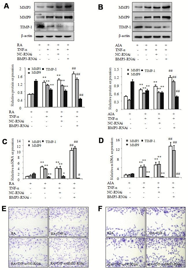 BMP3 siRNA silencing promotes the migration of RA and AIA FLS. (A) The protein levels of MMP-3, MMP-9, and TIMP-1 in TNF-α–treated RA FLS transfected with BMP3 siRNA were analyzed using western blot. (B) The protein levels of MMP-3, MMP-9, and TIMP-1 in TNF-α–treated AIA FLS transfected with BMP3 siRNA were analyzed using western blot. (C) The mRNA levels of MMP-3, MMP-9, and TIMP-1 in TNF-α–treated RA FLS transfected with BMP3 siRNA were analyzed using qPCR. (D) The mRNA levels of MMP-3, MMP-9, and TIMP-1 in TNF-α–treated AIA FLS transfected with BMP3 siRNA were analyzed using qPCR. (E) TNF-α–treated AIA FLS were transfected with BMP3 siRNA, and their migration into the wound-healing site after 24 hours was photographed (original magnification, ×10). (F) TNF-α–treated AIA FLS were transfected with BMP3 siRNA, and their migration into the wound-healing site after 24 hours was photographed (original magnification, ×10). All values are expressed as the mean ± SD. *P **P #P ##P 