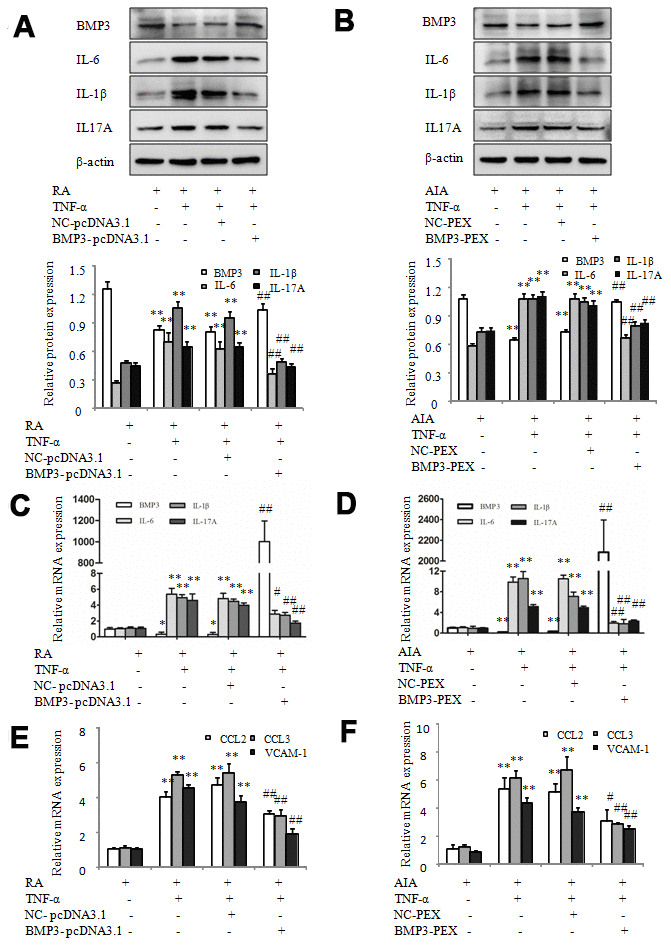 Overexpression of BMP3 decreases proinflammatory cytokines and chemokines in RA and AIA FLS. (A) The protein levels of BMP3, IL-6, IL-1β, and IL-17A in TNF-α–treated RA FLS transfected with BMP3-pcDNA3.1 were analyzed using western blot. (B) The protein levels of BMP3, IL-6, IL-1β, and IL-17A in TNF-α–treated AIA FLS transfected with BMP3-PEX were analyzed using western blot. (C) The mRNA levels of BMP3, IL-6, IL-1β, and IL-17A in TNF-α–treated RA FLS transfected with BMP3-pcDNA3.1 were analyzed using qPCR. (D) The mRNA levels of BMP3, IL-6, IL-1β, and IL-17A in TNF-α–treated AIA FLS transfected with BMP3-PEX were analyzed using qPCR. (E) The mRNA levels of CCL2, CCL3, and VCAM-1 in TNF-α–treated RA FLS transfected with BMP3-pcDNA3.1 were analyzed using qPCR. (F) The mRNA levels of CCL2, CCL3, and VCAM-1 in TNF-α–treated AIA FLS transfected with BMP3-PEX were analyzed using qPCR. All values are expressed as the mean ± SD. *P **P #P ##P 