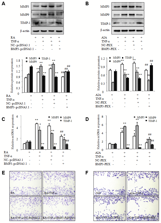 Overexpression of BMP3 inhibits the migration of RA and AIA FLS. (A) The protein levels of MMP-3, MMP-9, and TIMP-1 in TNF-α–treated RA FLS transfected with BMP3-pcDNA3.1 were analyzed using western blot. (B) The protein levels of MMP-3, MMP-9, and TIMP-1 in TNF-α–treated AIA FLS transfected with BMP3-PEX were analyzed using western blot. (C) The mRNA levels of MMP-3, MMP-9, and TIMP-1 in TNF-α–treated RA FLS transfected with BMP3-pcDNA3.1 were analyzed using qPCR. (D) The mRNA levels of MMP-3, MMP-9, and TIMP-1 in TNF-α–treated AIA FLS transfected with BMP3-PEX were analyzed using qPCR. (E) TNF-α–treated RA FLS were transfected with BMP3-pcDNA3.1, and their migration into the wound-healing site after 24 hours was photographed (original magnification, ×10). (F) TNF-α–treated AIA FLS were transfected with BMP3-PEX, and their migration into the wound-healing site after 24 hours was photographed (original magnification, ×10). All values are expressed as the mean ± SD. *P **P #P ##P 