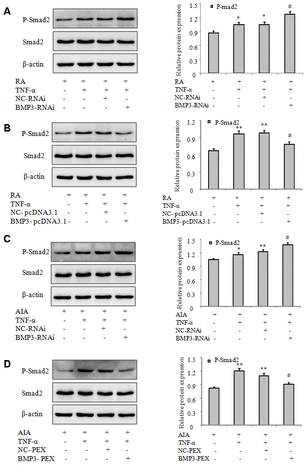 BMP3 regulates the proinflammatory response and migration of FLS and may be associated with the TGF-β1/Smad signaling pathway. (A) The protein levels of p-Smad2 in RA FLS transfected with BMP3 siRNA were analyzed using western blot. (B) The protein levels of p-Smad2 in RA FLS transfected with BMP3-PEX were analyzed using western blot. (C) The protein levels of p-Smad2 in AIA FLS transfected with BMP3-RNAi were analyzed using western blot. (D) The protein levels of p-Smad2 in AIA FLS transfected with BMP3-pcDNA3.1 were analyzed using western blot. All values are expressed as the mean ± SD. *P **P #P ##P 