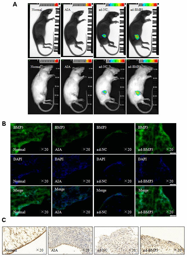 Overexpression of BMP3 by adenovirus in vivo alleviated arthritis severity in AIA rats. (A) In vivo imaging of normal and AIA rats. (B) Overexpression of BMP3 in AIA rat synovial tissues injected with ad-BMP3 was analyzed using immunofluorescence staining (original magnification, ×20). (C) BMP3 expression in AIA rat synovial tissues injected with ad-BMP3 was analyzed using IHC staining (original magnification, ×20).