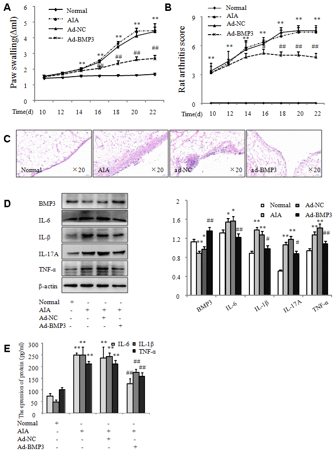 Overexpression of BMP3 by adenovirus in vivo alleviated arthritis severity in AIA rats. (A) The swelling of ankle joints was quantified using a plethysmometer. (B) Arthritis scores were reduced in AIA rats injected with ad-BMP3. (C) Representative H&E staining of normal and AIA rat synovial tissues (original magnification, ×20). (D) BMP3 protein levels in normal and AIA synovial tissues were analyzed using western blot. (E) Levels of IL-6, IL-1β, and TNF-α expression in the serum of AIA rats injected with ad-BMP3. All values are expressed as the mean ± SD. *P **P #P ##P 