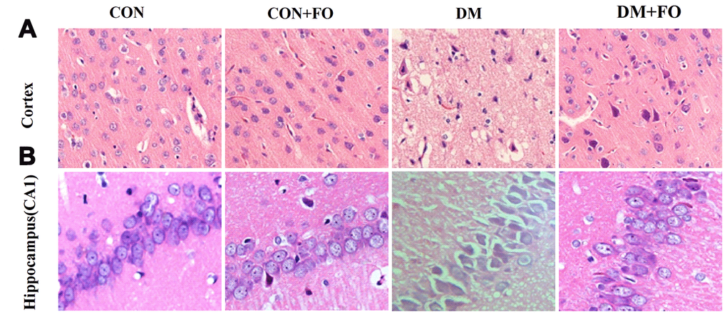 Morphological changes in cortical and hippocampal neurons. (A) Morphological changes in cortical nerve cells in rats from different groups, CON, CON+FO, DM and DM+FO; (B) Morphological changes of hippocampal neurons in rats from different groups, CON, CON+FO, DM and DM+FO. (n=8).