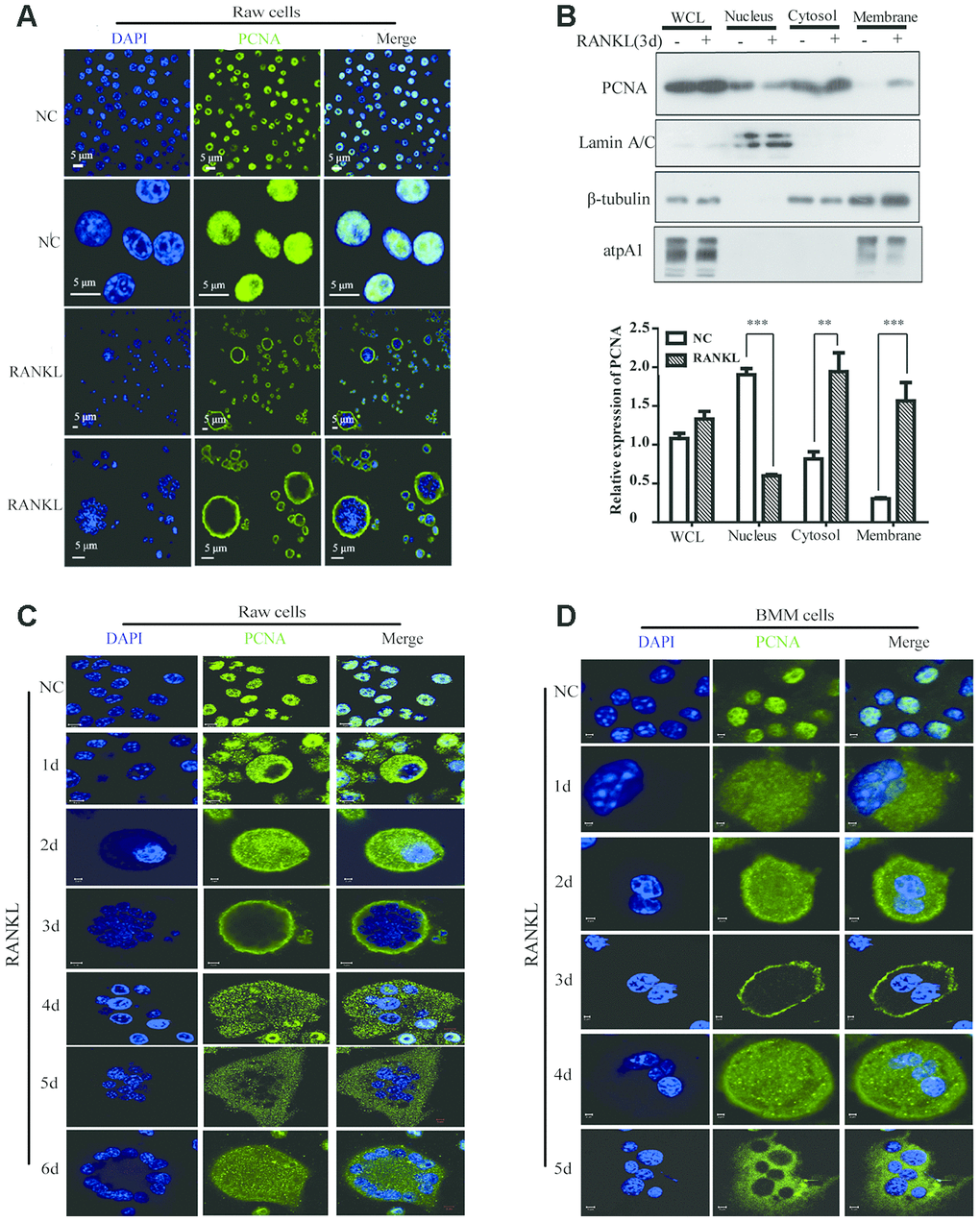 The subcellular localization of PCNA during the RANKL-induced osteoclast differentiation. (A) Nucleus-cytoplasm translocation of PCNA after 3-day RANKL treatment. RAW264.7 cells were treated with or without RANKL (100 ng/mL) for 3 days to induce osteoclast differentiation. Then, the cells were performed IF assay to test the cellular location of PCNA using primary PCNA antibody. DAPI staining was used to mark cell nucleus. Scale bar: 5μm. (B) PCNA subcellular distribution in differentiated osteoclast analyzed by cell fractionation assay. Upper panel: cell fractionation experiments were performed with RAW264.7 previously treated with or without RANKL (100 ng/mL) for 3 days to induce osteoclast differentiation. PCNA protein in various cell fractions was detected by western blotting. Lamin A/C, β-tubulin and atpA1 were respectively used as markers of nucleus, cytosol, and membrane fractions. Lower panel: the quantification of PCNA expression in WCL, Nucleus, Cytosol, and Membrane fractions of three independent experiments. (C) Tracking of PCNA subcellular localization during the 6-day RANKL treatment of RAW264.7 cells. IF assays were performed with RAW264.7 cells treated with or without RANKL (100 ng/mL) for the indicated times of treatment. Scar bar: 2-5μm. (D) Tracking of PCNA subcellular localization during the 5-day RANKL treatment of BMM cells. After isolation, BMM cells were cultivated with M-CSF (10 ng/mL) and RANKL (100 ng/mL) for 5 days to induce the osteoclast differentiation, and analyzed as described in (C). Scar bar: 2-5μm.