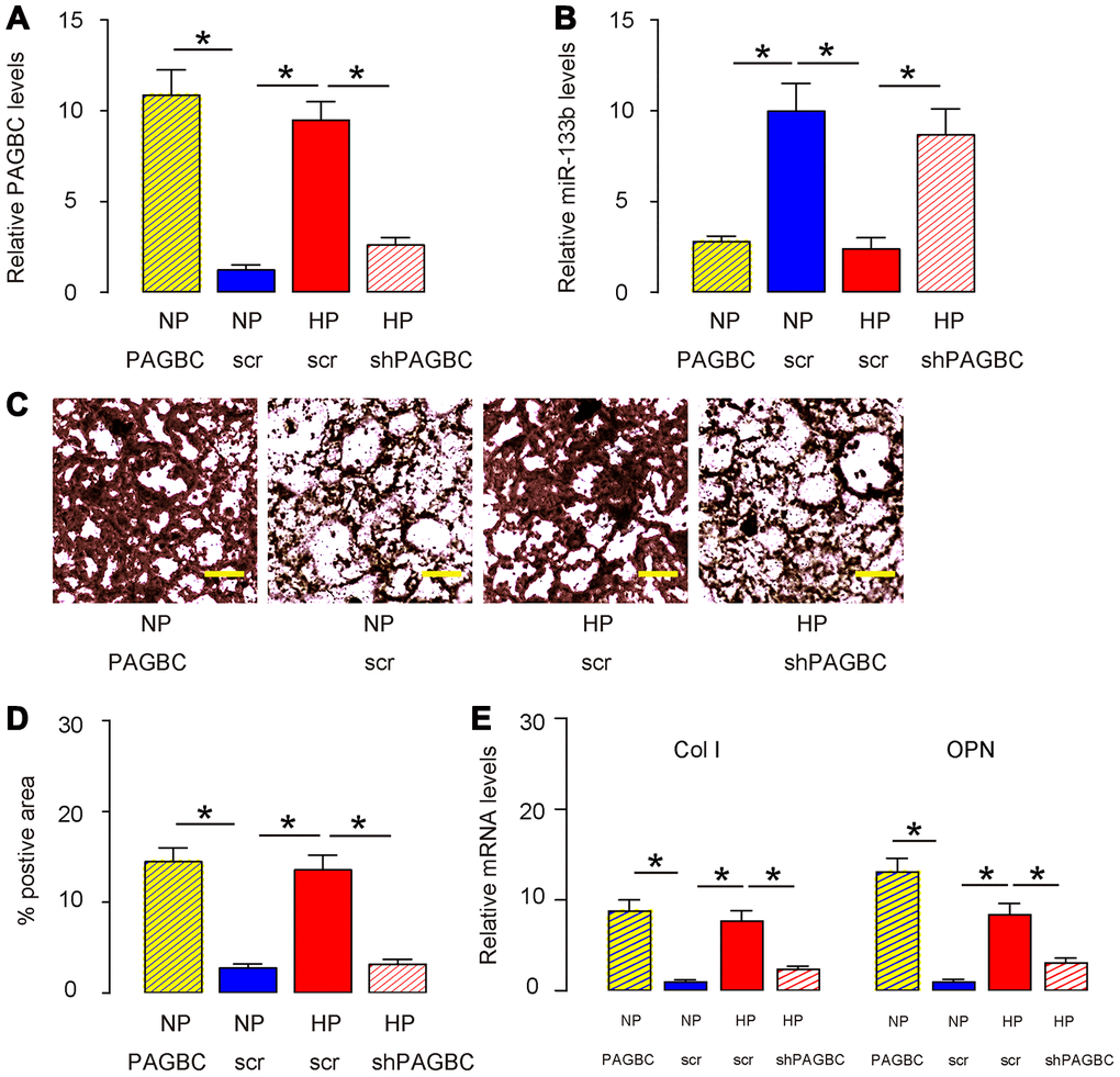 HP induces osteogenic differentiation of AMSCs through PAGBC. AMSCs transfected with scr were kept in either NP or HP, while AMSCs transfected with PAGBC were kept in NP, AMSCs transfected with shPAGBC were kept in HP, to compare with AMSCs in NP and AMSCs in HP, respectively. (A, B) RT-qPCR for PAGBC (A) and miR-133b (B) in AMSCs. (C, D) Osteogenic differentiation of AMSCs was determined by Von kossa staining, shown by quantification (C) and by representative images (D). (E) RT-qPCR for osteogenesis-associated genes, collagen I (Col I) and osteopontin (OPN). N=5. *p