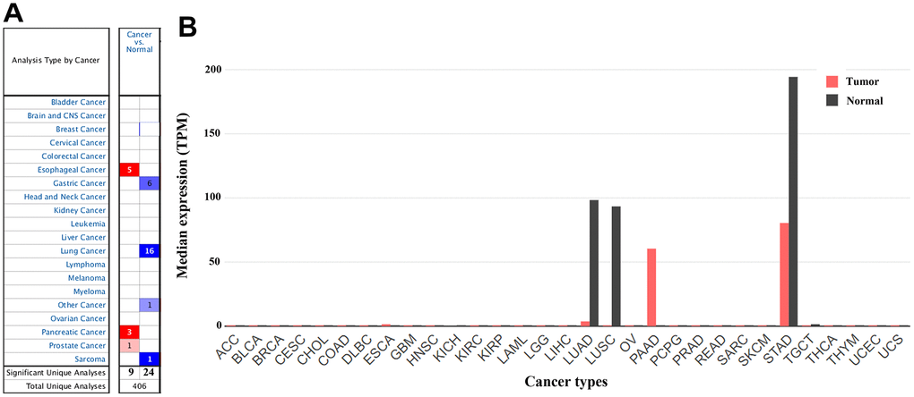 The gene expression profiles of CLDN18 across all tumor samples. (A) mRNA expression levels of CLDN18 in various types of cancer from the Oncomine database. The cell number represents the number of datasets that met the thresholds. The color intensity is proportional to the significance of dysregulation. (B) The gene expression profiles of CLDN18 across all tumor samples and paired normal tissues in the GEPIA2 database. The height of the bar represents the median expression level. TPM, transcripts per kilobase of exon per million mapped reads.