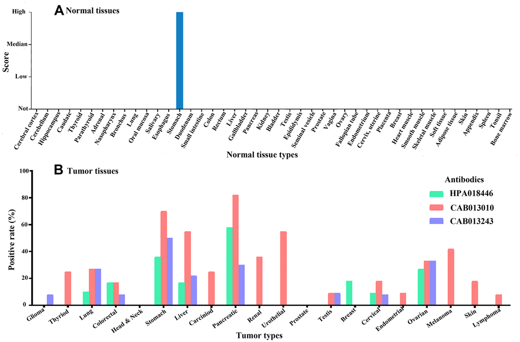 The expression of Claudin 18 in normal (A) and tumor (B) tissues.