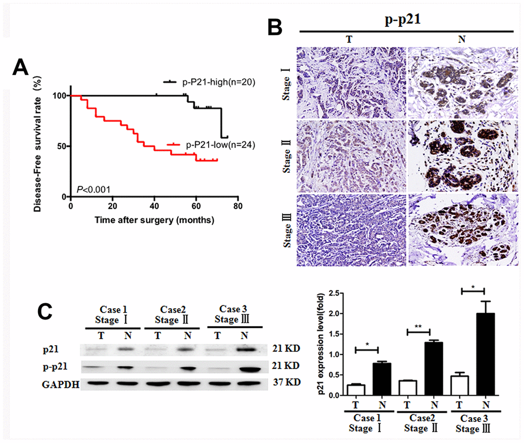 Reduced p-p21/p21 expression in tumoral tissues of patients with breast cancer. (A) Positive correlation of the disease-free survival rate of patients with the levels of p-p21 expression. (B, C) P-p21 expression in BC tumoral tissues (T) and BC-adjacent non-tumoral tissues (N) of patients with different clinical stages was evaluated by immunohistochemistry and western blotting. *P 