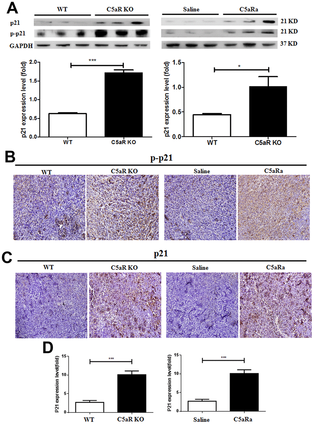 C5aR deficiency or C5aR signaling blockade inhibits the downregualtion of p21 expression in tumor tissues of mice. Mice were received 4T-1 cells transplantation for tumor development and sacrificed in the indicated time. (C5aRa treatment group: WT mice were injected with C5aRa 30 min prior to 4T-1 cells transplantation. Saline was used as the control of C5aRa). The tumors tissues were collected. The expression of p21 and p-p21 was measured by western blotting (A) and immunohistochemistry (B, C). (D) The mRNA levels of p21 were measured by quantitative RT-PCR. (n=5-6/group). *P 