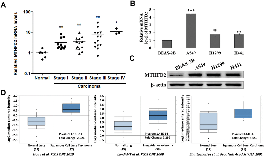 Levels of MTHFD2 in lung cancer tissues and cell lines. (A) Relative MTHFD2 gene expression of normal lung tissues and the different stages of lung cancer tissues. * and ** indicate ppt-test, compared to normal group. (B) Relative MTHFD2 gene expression of normal lung cell line BEAS-2B and lung cancer cell lines A549, H1299 and H441. ** and *** indicate ppC) Representative MTHFD2 protein expression in normal and lung cancer cell lines, where β-actin was loaded as relative control (D) Online Oncomine database-dependent (https://www.oncomine.org/) in silico analysis of fold changes in MTHFD2 expression in lung cancer tissues. MTHFD2 mRNA expression in normal and malignant lung specimens are presented as box and whisker plots. Sample numbers, fold changes, and p-value for MTHFD2 expression between normal and malignant specimens are indicated. Data are expressed as mean ± SD.