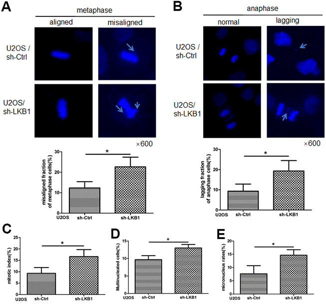 LKB1 inactivation leads to centromere defects and genome